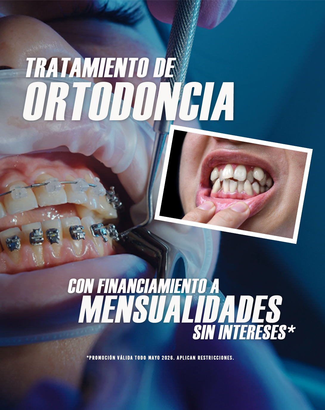 Que Brille Tu SONRISA